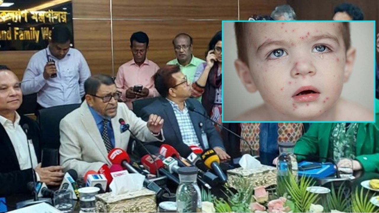 আশঙ্কাজনক হারে বাড়ছে ব্যাধি হাম, রোববার থেকে টিকাদান কর্মসূচী শুরু