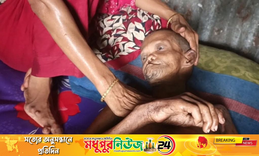 কমলনগরে অর্থের অভাবে বিনা চিকিৎসায় শয্যাশায়ী প্রতিবন্ধী জহির